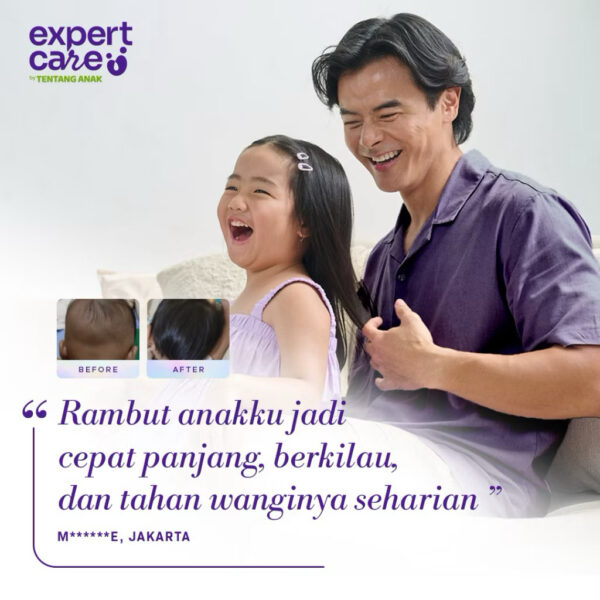 Expert Care Hair Nutrilotion 100ml - Lotion Penumbuh Rambut Anak Bayi dengan Nutribiotic, Aman untuk Kulit Sensitif