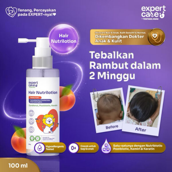 Expert Care Hair Nutrilotion 100ml - Lotion Penumbuh Rambut Anak Bayi dengan Nutribiotic, Aman untuk Kulit Sensitif