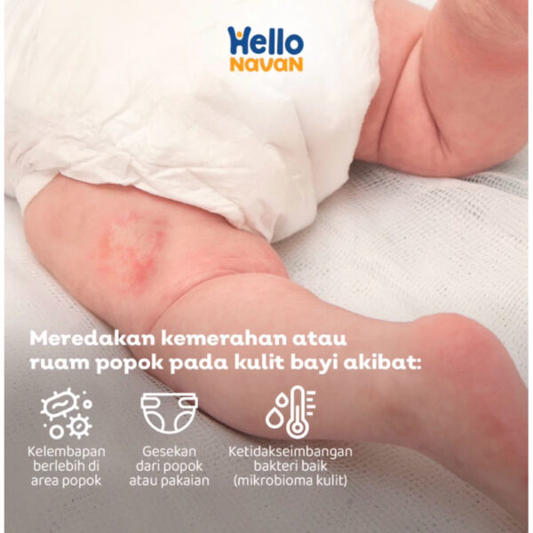 Hello Navan Bumbum Diaper & Rash Cream ruam popok 40gr