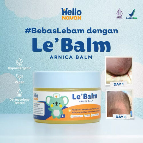 Hello Navan Le'Balm Arnica Balm salep memar anak