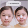 KOYO YUAN HONG HIDUNG ALERGI (Sinusitis) / Koyo Anak / Koyo Herbal / Alami / Obat Flu / Alergi / Hidung Tersumbat / sinus