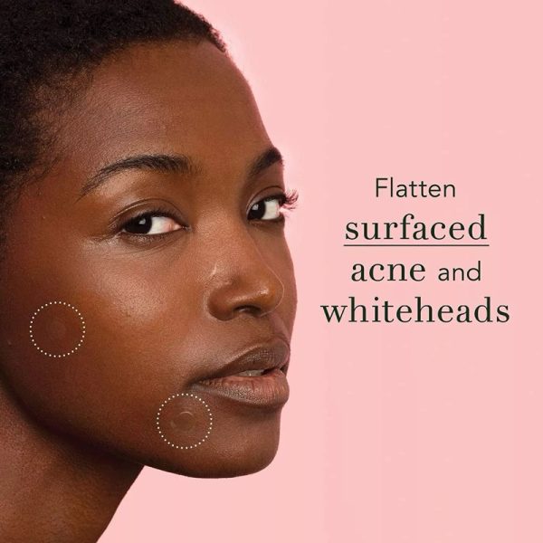 Royal Prestige Ultra Thin Acne Patch 72pcs patch jerawat tempelan jerawat acneway mymi acne patch